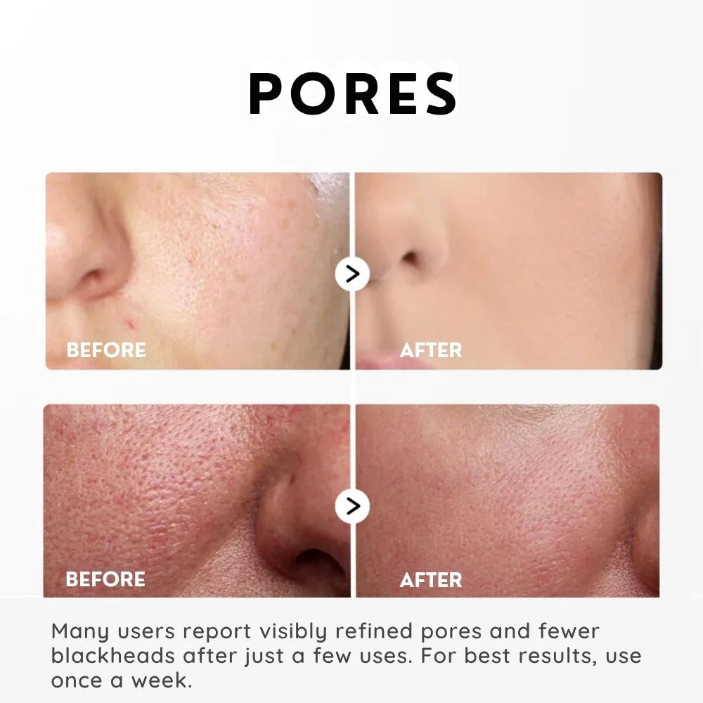 SkinShed™ | Rice Peeling Essence – Dead Skin Off, Glow On Instantly