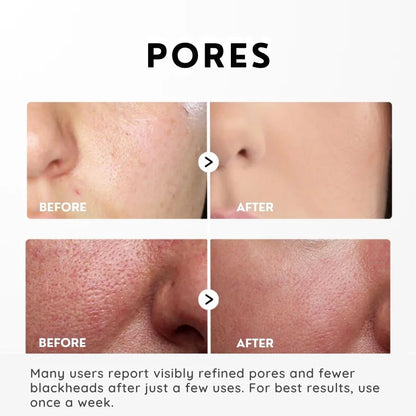 SkinShed™ | Rice Peeling Essence – Dead Skin Off, Glow On Instantly