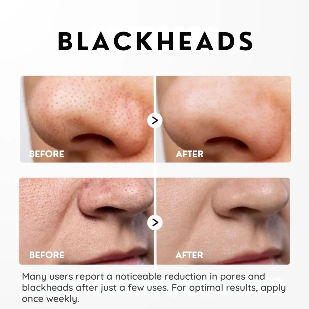 SkinShed™ | Rice Peeling Essence – Dead Skin Off, Glow On Instantly