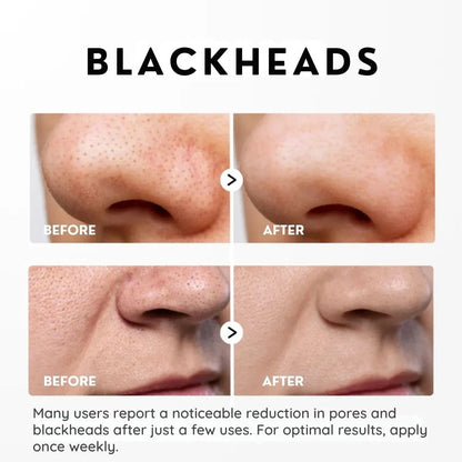 SkinShed™ | Rice Peeling Essence – Dead Skin Off, Glow On Instantly