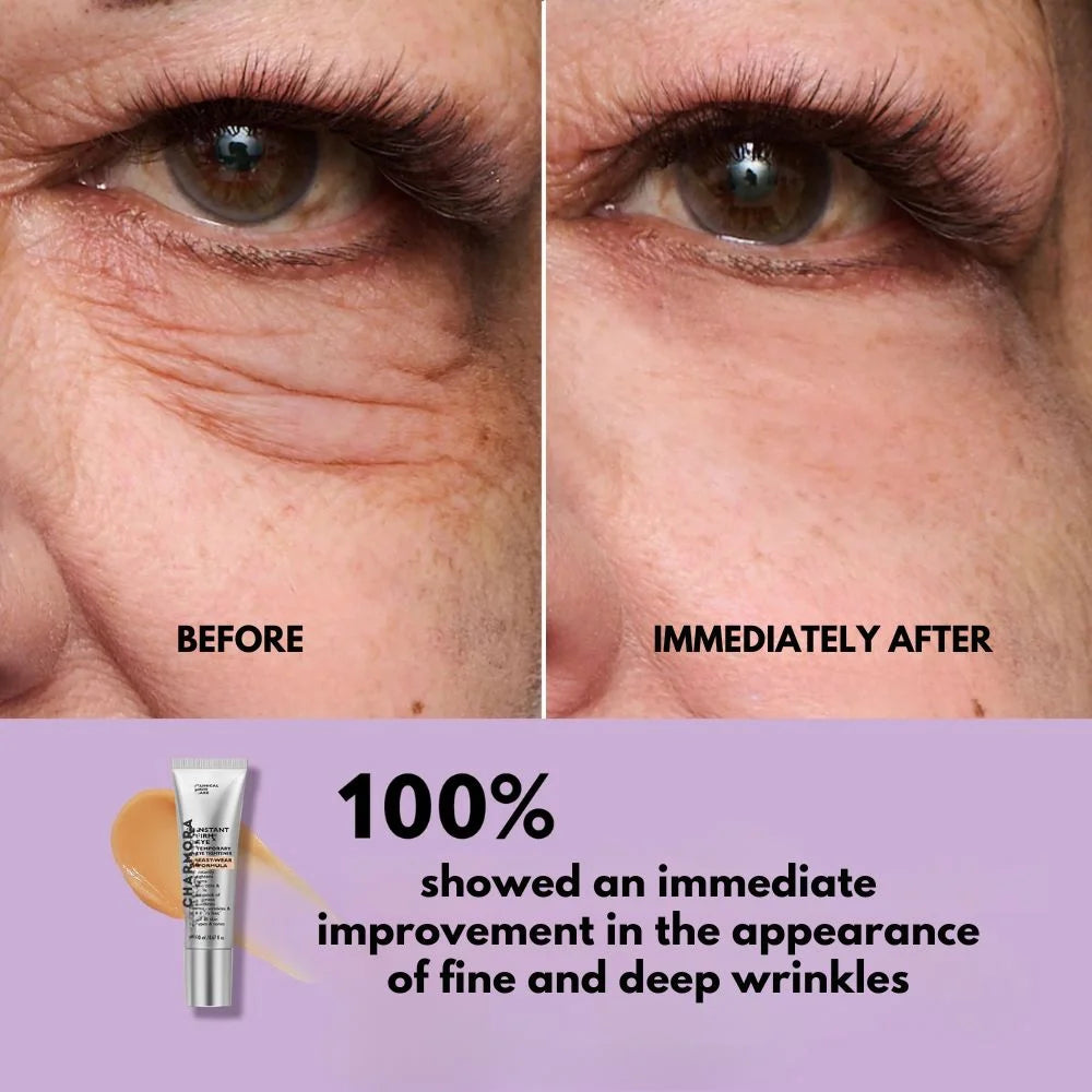 SmoothEyes™ | Anti-Wrinkle Eye Serum – Lift, Smooth & Brighten Instantly