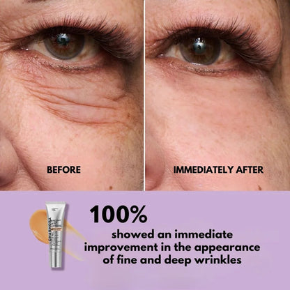 SmoothEyes™ | Anti-Wrinkle Eye Serum – Lift, Smooth & Brighten Instantly