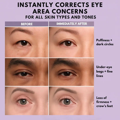 SmoothEyes™ | Anti-Wrinkle Eye Serum – Lift, Smooth & Brighten Instantly